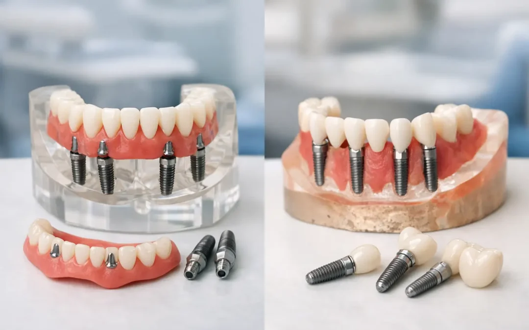 All-on-4 vs Traditional Implants