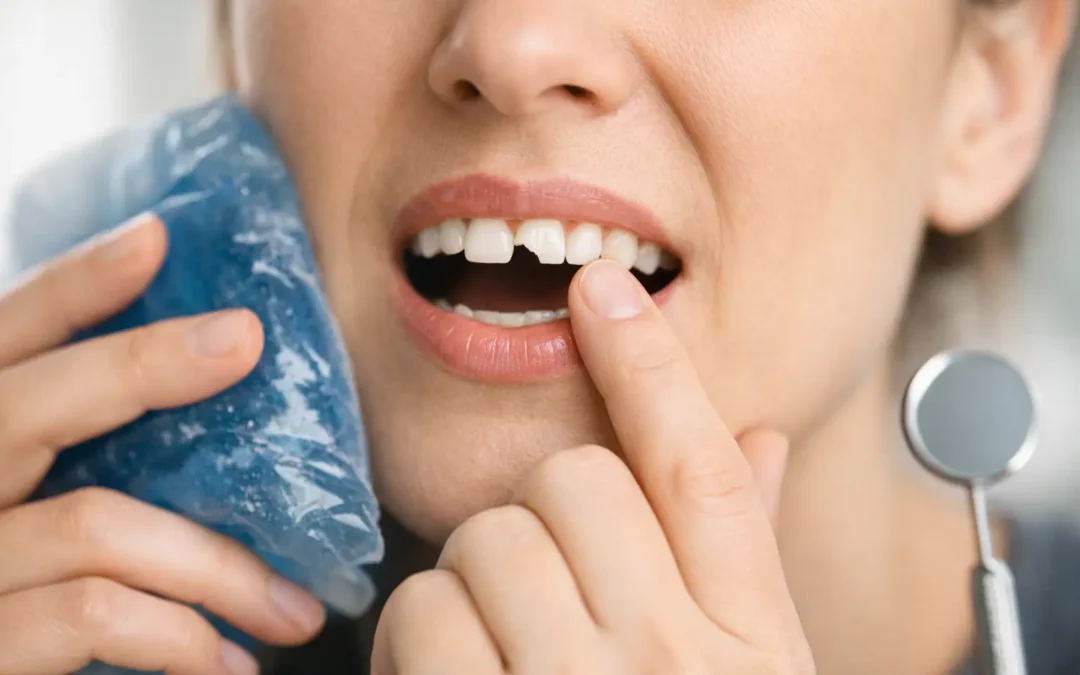 How to Handle a Broken Tooth Without Making It Worse